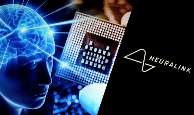 米国のニューラリンク社では埋め込み型脳コンピューターインターフェースを開発している（ZUMA　Press/アフロ）