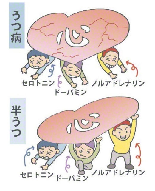 【神経伝達機能の乱れ】
