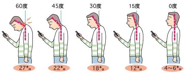 首の角度による頸部負荷の変化
