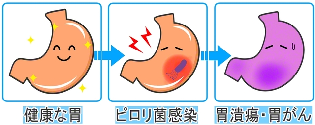 イラストAC